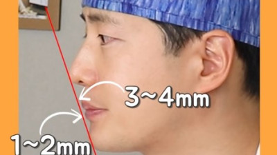 무턱 자가진단법